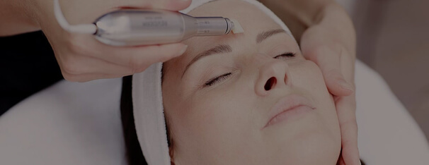 Microneedling, Kosmetik Hamburg, Skin Treatment Institut Hamburg